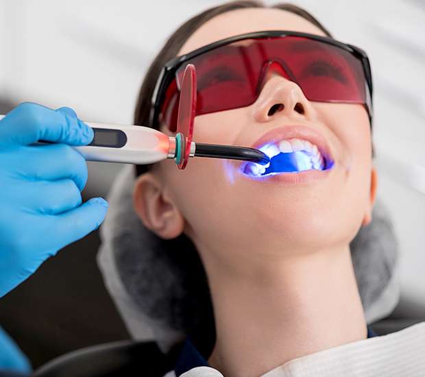 North Hollywood Professional Teeth Whitening
